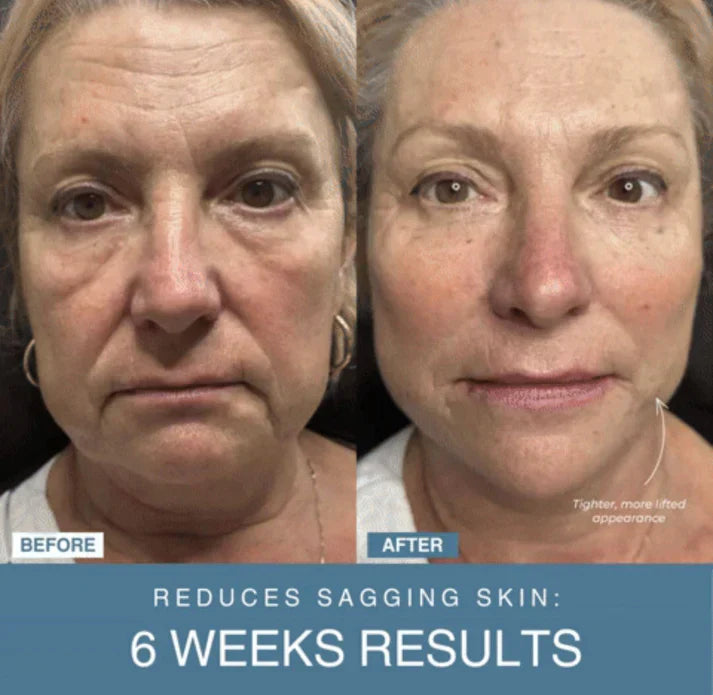 Curato by DZ™ 7-in-1 LED Anti-Aging/Wrinkle Apparatus