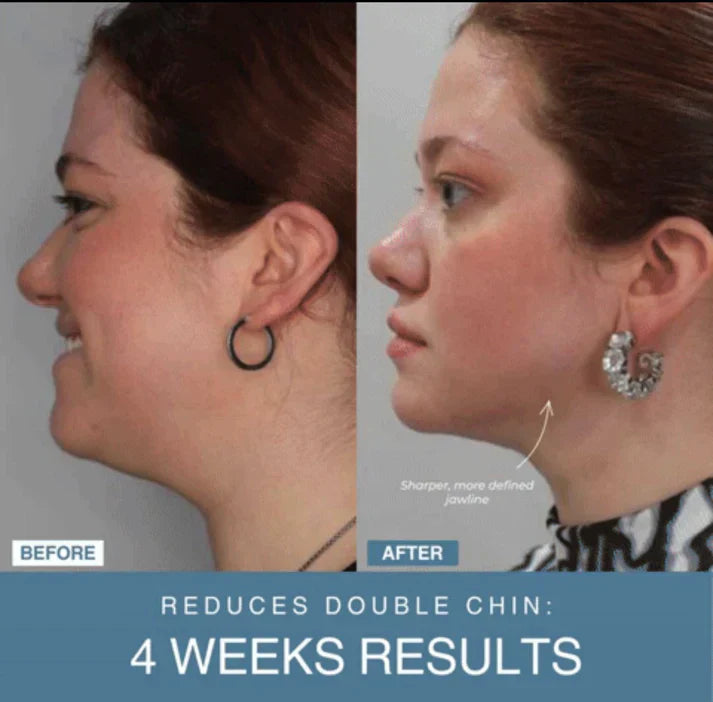 Curato by DZ™ 7-in-1 LED Anti-Aging/Wrinkle Apparatus