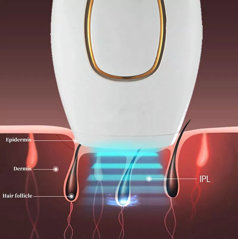Curato by DZ™ IPL Laser Hair Removal – جهاز إزالة الشعر بالليزر IPL
