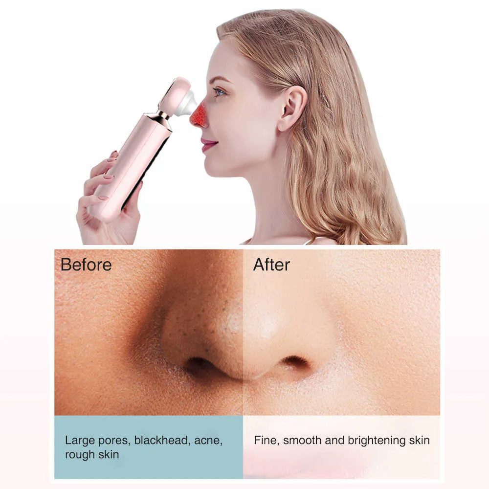 Curato by DZ™ Blackhead Suction Machine